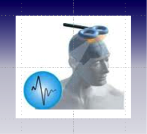 TMS-300x273
